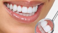 stomatologia preventiva