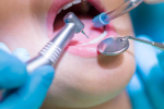 tipuri de interventii chirurgicale orale