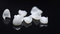 fatete dentare portelan