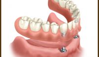 clinica dentara Elveto Dent