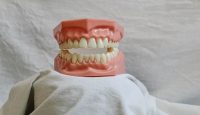 Pulpita dentară